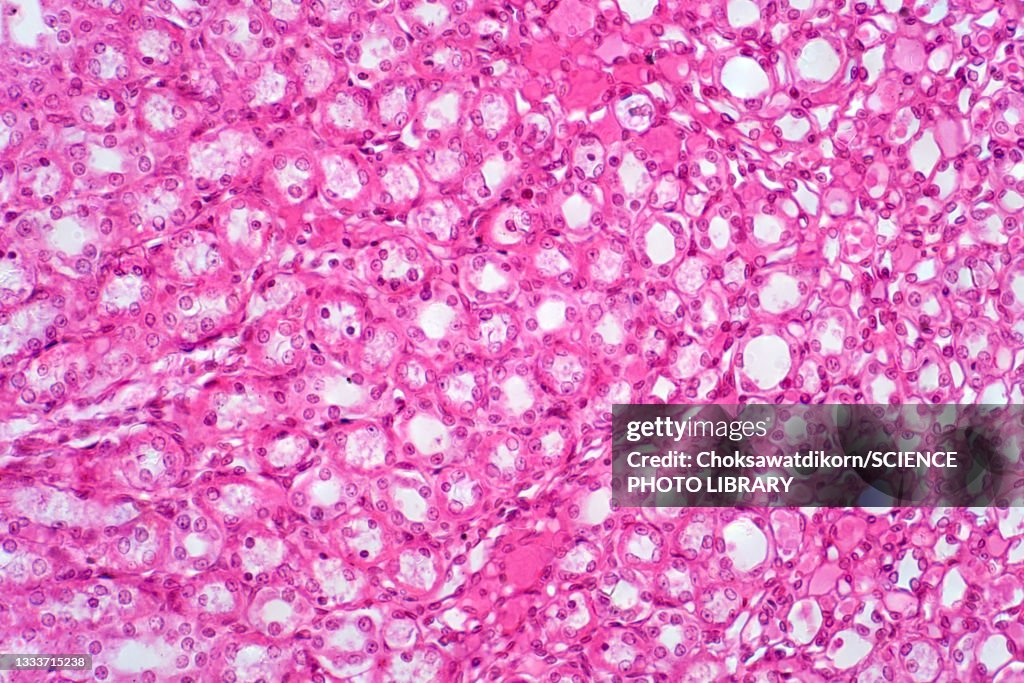 Human kidney tissue, light micrograph
