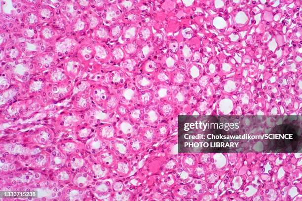 human kidney tissue, light micrograph - histologia - fotografias e filmes do acervo