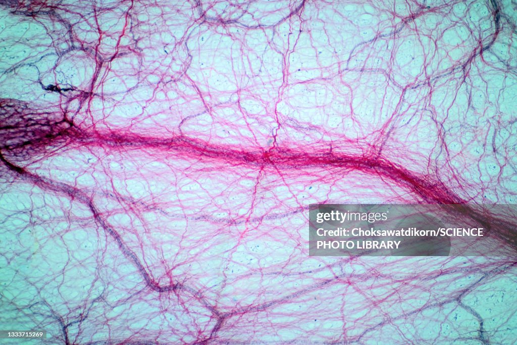 Areolar connective tissue, light micrograph