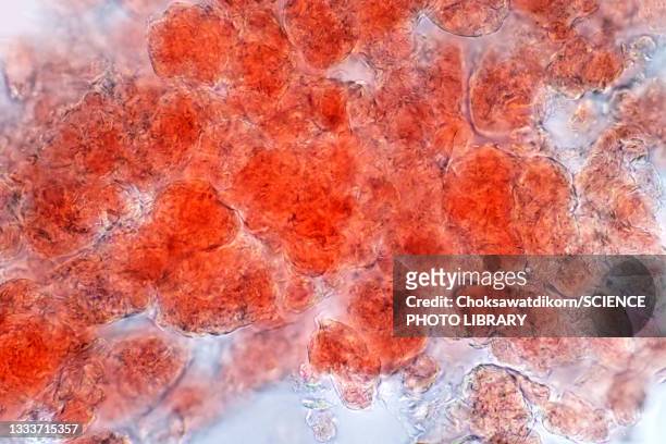 adipose tissue, light micrograph - fettgewebezelle stock-fotos und bilder