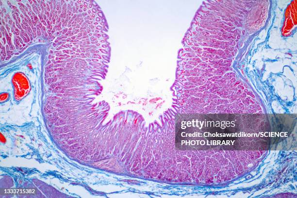 colon biopsy, light micrograph - darmschleimhaut stock-fotos und bilder