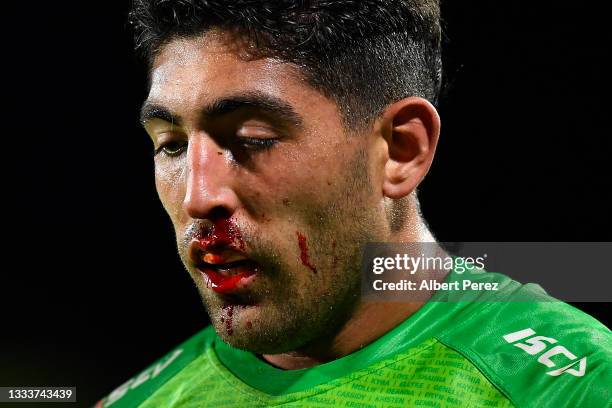 Emre Guler of the Raiders walks off the field with a bloodied nose during the round 22 NRL match between the Melbourne Storm and the Canberra Raiders...