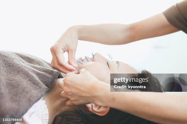 acupuntura cosmética facial para mulheres na ásia - acupuncture - fotografias e filmes do acervo