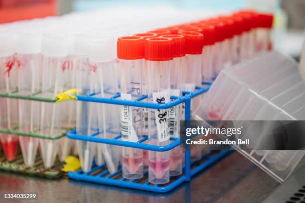 Vils Lab Lab Viles Photos and Premium High Res Pictures - Getty Images