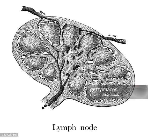 Limnode 49 Lymph Node Drawing Stock Photos, High-Res Pictures, and Images ...