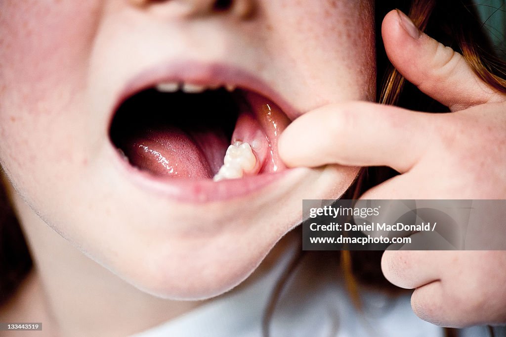 Young girl showing off her new molars