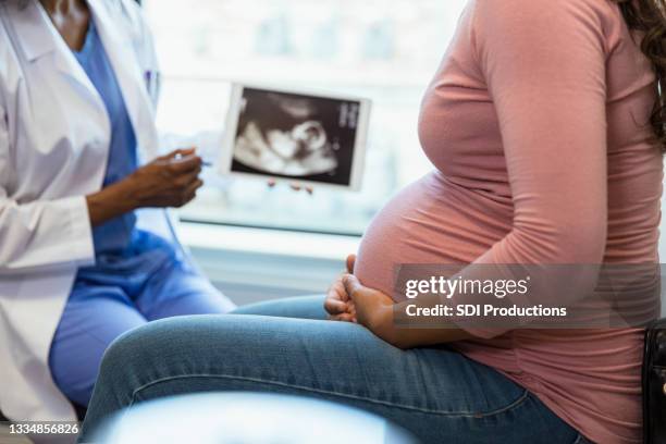 focus on foreground as doctor shows ultrasound in background - prenatal vård bildbanksfoton och bilder
