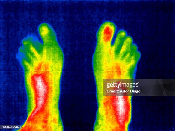 thermal image of a person's bare feet. - thermal imaging stock pictures, royalty-free photos & images