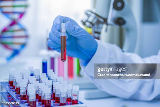 hands of a lab technician with a tube of blood sample and a rack with other samples / lab technician holding blood tube sample for study - human blood fotografías e imágenes de stock