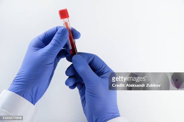 test or blood sample in a test tube, in the hands of a doctor or laboratory assistant on a white background or table. the concept of maintaining and checking health, health care. medical examination for the presence of antibodies to diseases and viruses. - 人間の血液 ストックフォトと画像