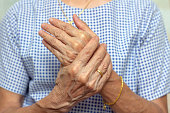 Holding hand adult woman with pain in muscles and joints,Symptoms of peripheral neuropathy and numbness in the fingertip and palm,Diseases caused by side effects of vaccination,Guillain Barre Syndrome(GBS)