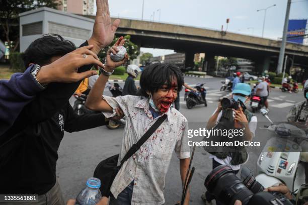 Anti-government protesters assist another protester who was reportedly shot with a rubber bullet on August 22, 2021 in Bangkok, Thailand....