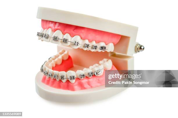 dental teeth model isolated on white background. - künstliches gebiss stock-fotos und bilder
