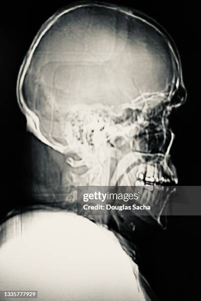mri scan of normal human head and neck - x ray skeleton stock pictures, royalty-free photos & images