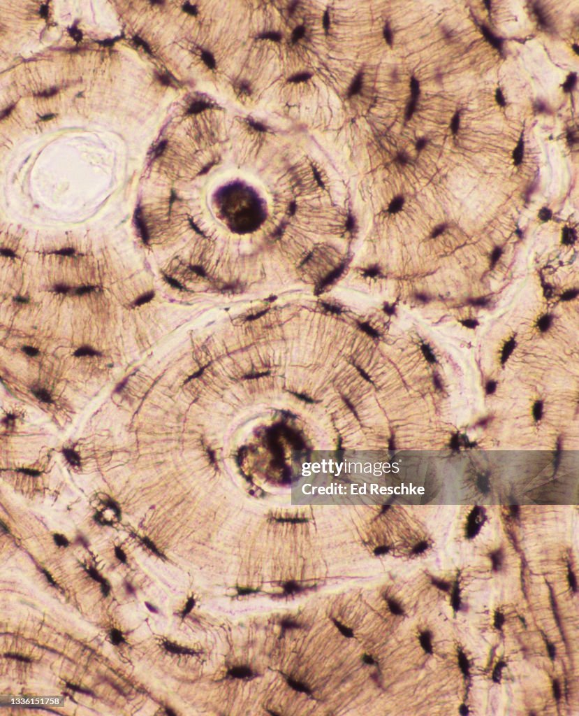 MICROSCOPIC STRUCTURE OF COMPACT BONE--OSTEONS or HAVERSIAN SYSTEMS, 100X