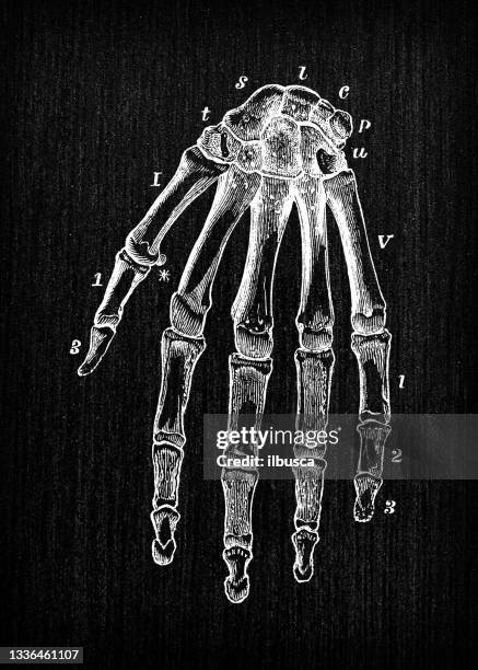 antique illustration of human body anatomy: hand - metacarpal stock illustrations