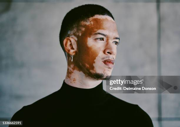 aufnahme eines jungen geschäftsmannes bei der arbeit - vitiligo stock-fotos und bilder
