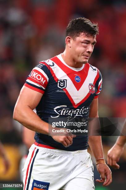 Joseph Manu of the Roosters is seen with a cheek injury after a tackle from Latrell Mitchell of the Rabbitohs during the round 24 NRL match between...