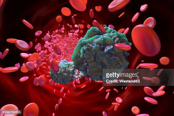 three dimensional render ofleukemia cells in blood stream - leukemia点のイラスト素材／クリップアート素材／マンガ素材／アイコン素材