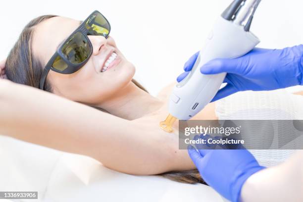 beauty clinic: laser therapy - behaart stock-fotos und bilder