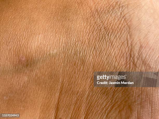 close up of human skin - piel humana fotografías e imágenes de stock