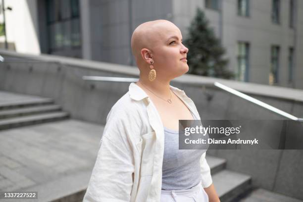 ukrainian woman with alopecia - hair loss in woman stock pictures, royalty-free photos & images