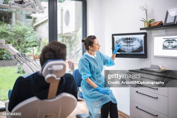 dentist explaining tooth x-rays to a patient. - implantat bildbanksfoton och bilder