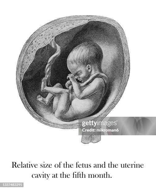 old engraved illustration of positions of the fetus in womb - relative size of the fetus and the uterine cavity at the fifth month - position du foetus photos et images de collection