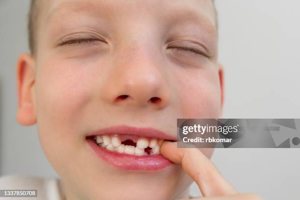 happy boy shows off missing teeth close up - losing teeth stock pictures, royalty-free photos & images