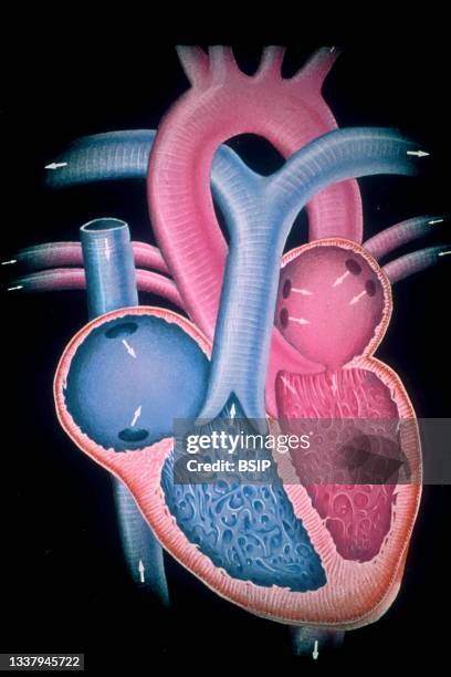 The heart is the organ that makes blood circulate. Its muscle, the myocardium, receives stimulation from nerves, then contracts and propels the blood...