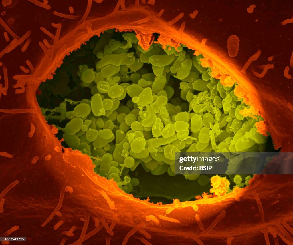 Coxiella burnetii, the bacteria that cause q fever.
