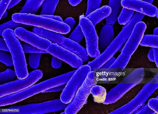 Colorized scanning electron micrograph of Escherichia coli, grown in culture and adhered to a cover slip.