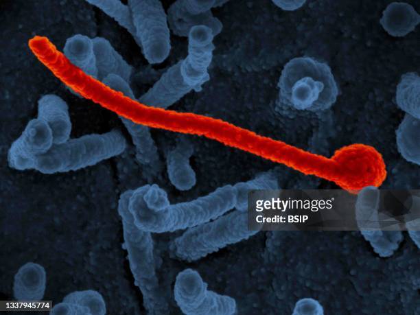Scanning electron micrograph of Ebola virus Makona from the West African epidemic shown on the surface of Vero cells .
