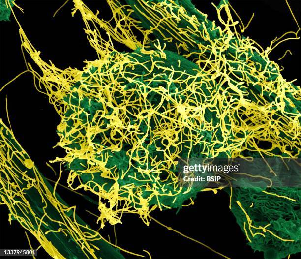 Embole Microscope Ebola Microscope Photos and Premium High Res Pictures - Getty Images