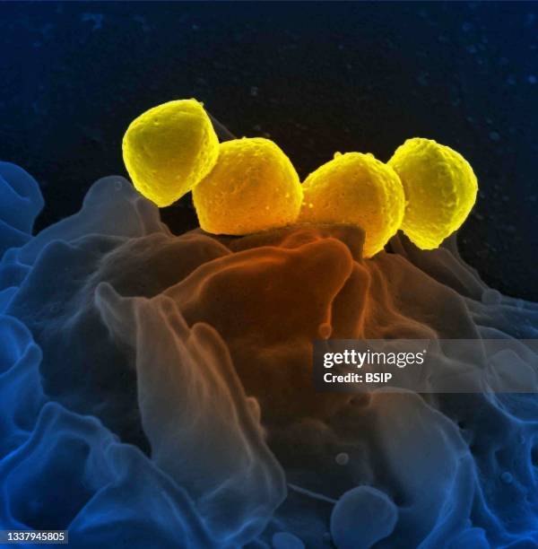 Scanning electron micrograph of Group A Streptococcus bacteria on primary human neutrophil.