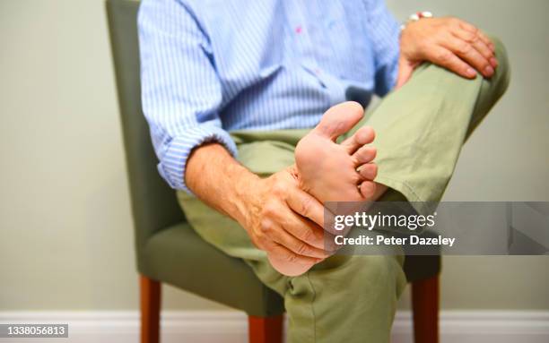 man rubbing foot, foot pain - gotta foto e immagini stock