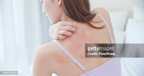 woman scratching her back - human skin stock pictures, royalty-free photos & images