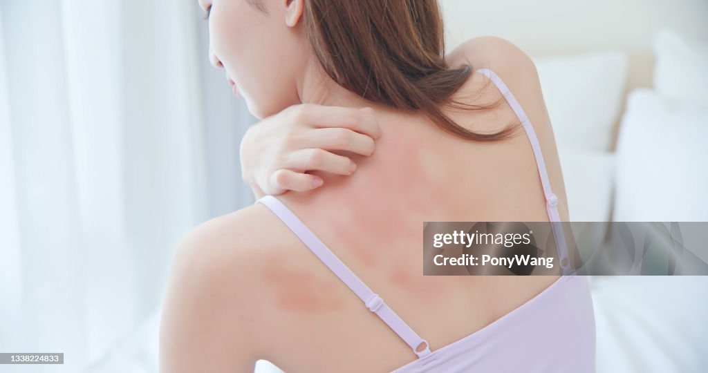 Woman scratching her back
