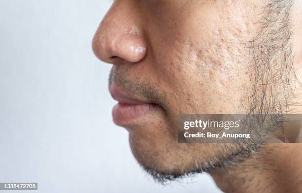 side view of asian man face with beard grows on a part of lower face and his cheek. - pore stock pictures, royalty-free photos & images