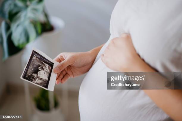 mujer embarazada sosteniendo una imagen de ecografía para bebés - baby touching belly fotografías e imágenes de stock
