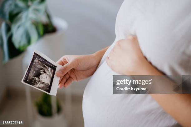 pregnant woman holding ultrasound baby scan image - abdomen scan stock pictures, royalty-free photos & images