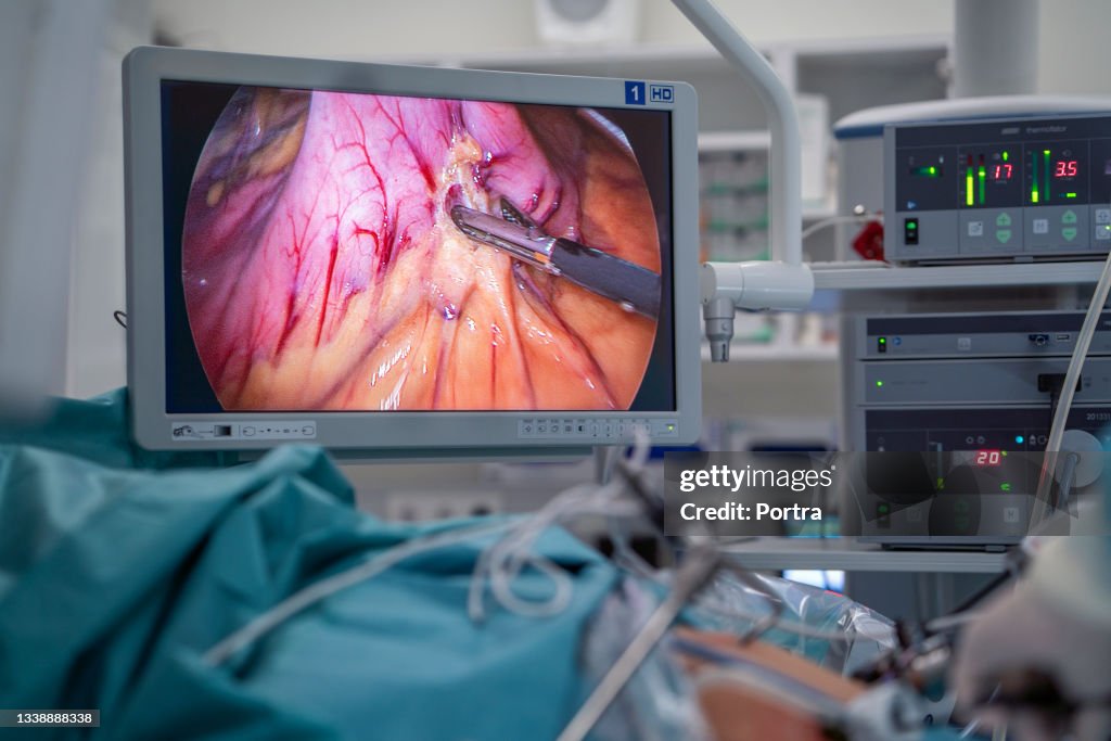Doctors performing bariatric surgery