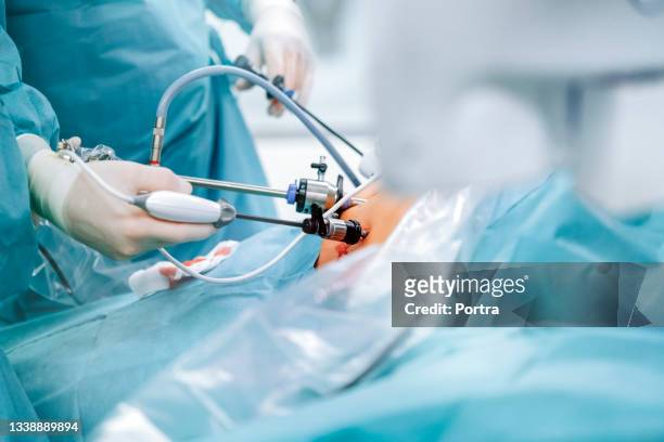doctors performing gastric bypass surgery - surgery stock pictures, royalty-free photos & images
