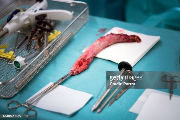 human internal organ with surgical instruments - bariatric stock pictures, royalty-free photos & images