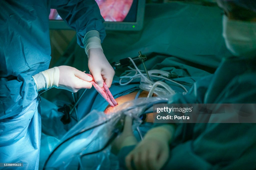 Surgeons removing internal organ during surgery