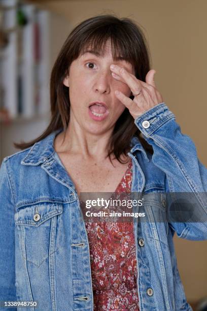 woman rubs her left eye because she suffers from allergy - left eye stock pictures, royalty-free photos & images