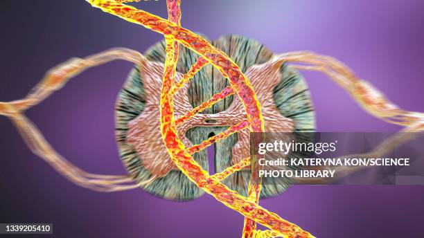 genetic spinal cord disorders, conceptual illustration - reflex hammer stock illustrations