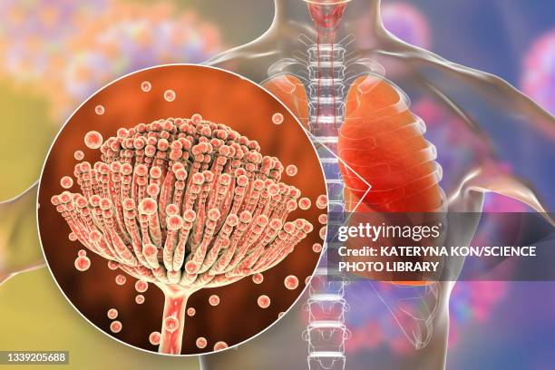 pulmonary aspergillosis, illustration - aspergillus fumigatus stock illustrations