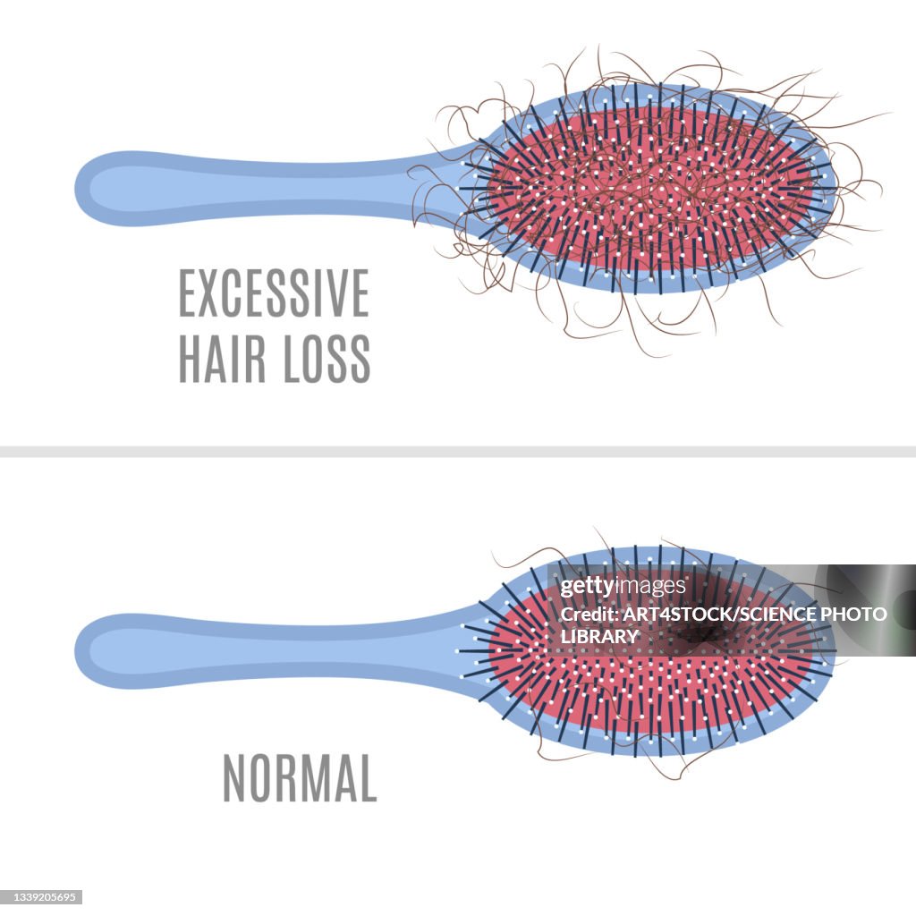 Hair loss, conceptual illustration