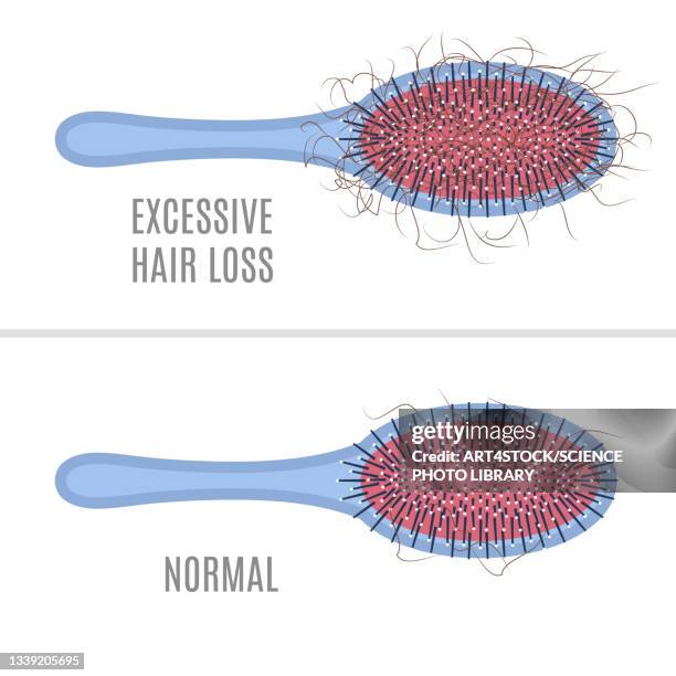 ilustraciones, imágenes clip art, dibujos animados e iconos de stock de hair loss, conceptual illustration - pérdida de pelo